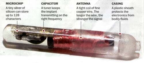 Microchip description