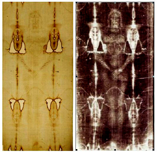 The Shroud of Turin